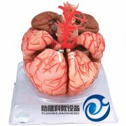 腦動脈模型