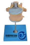 腰椎附脊髓與馬尾神經(jīng)放大模型
