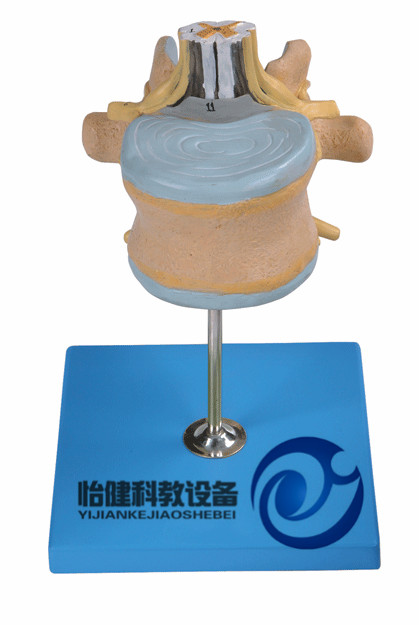 腰椎附脊髓與馬尾神經(jīng)放大模型