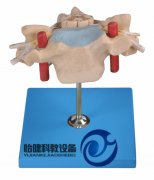 頸椎附脊髓和脊神經(jīng)放大模型