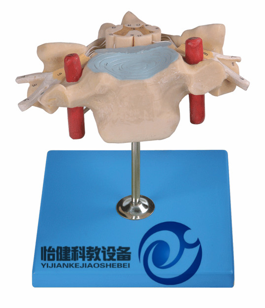 頸椎附脊髓和脊神經(jīng)放大模型