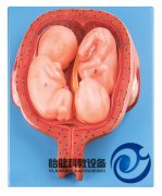 五個月雙胞胎模型